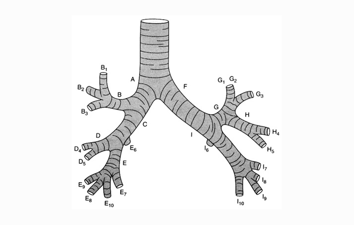 главный бронх левого легкого. верхнедолевой бронх левого легкого анатомия. ветвление бронхов в легких схема. трахея и главные бронхи. ветвление бронхов в легких схема.