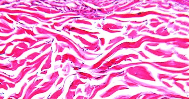 Dense rregular Connective Tissue Medically dense-rregular-connective-tissue-medically