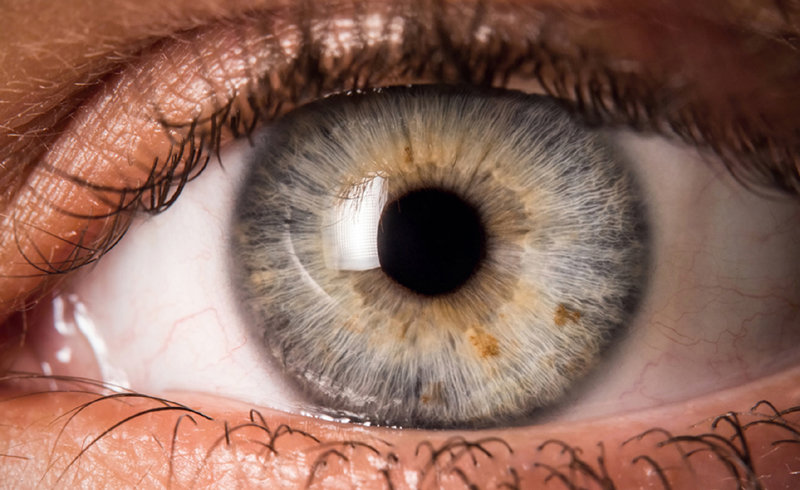 What are eye floaters?