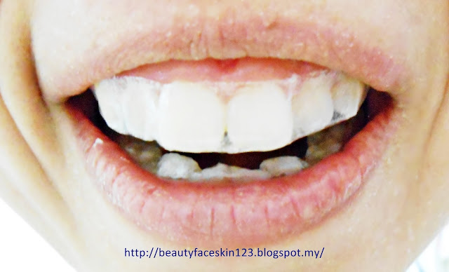 ORAL-B 3D WHITE WHITESTRIPS