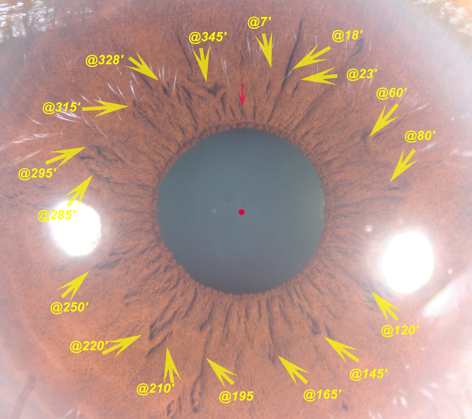 Modern & Multidimensional Iridology Emotional Dynamics of The