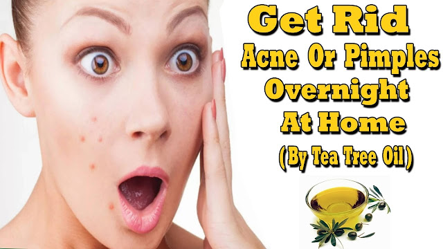 get rid of a painful pimple