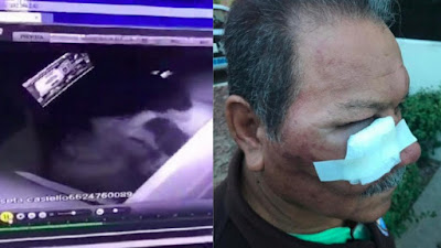 Guardia pierde memoria y sufre sordera tras golpes de boxeadores: Empresa