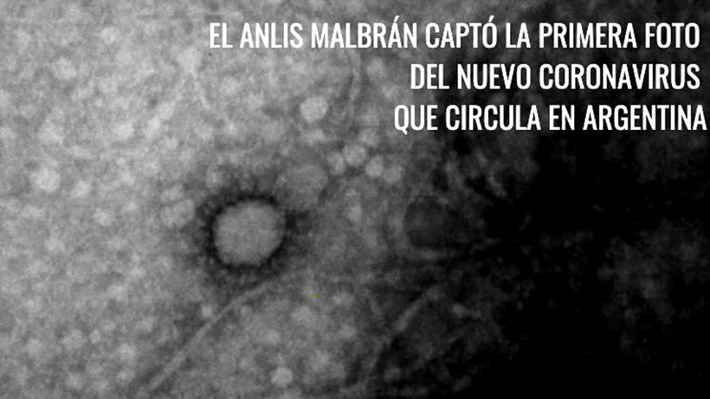 El ANLIS-Malbran logró captar la primera foto del nuevo coronavirus que circula en Argentina El ANLIS-Malbran logró captar la primera foto del nuevo coronavirus que circula en Argentina