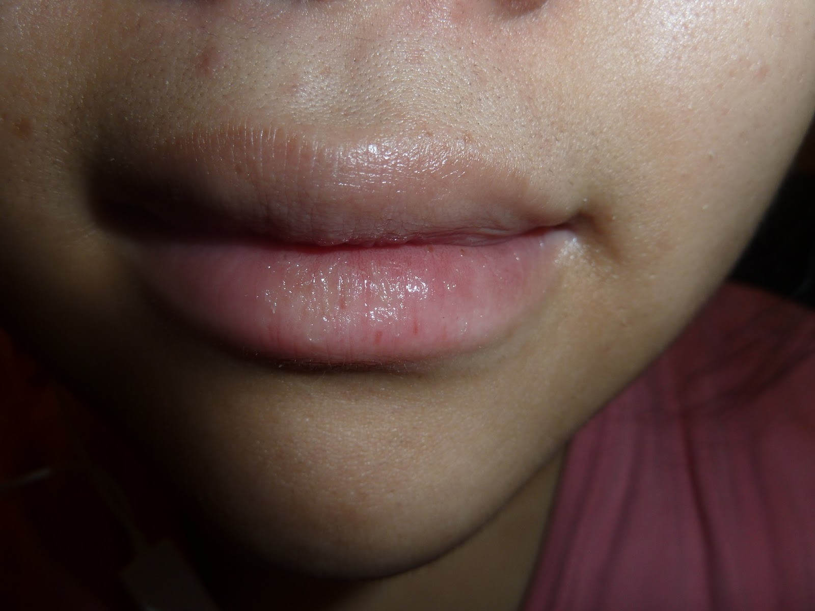 Solution to Chapped Lips Zowie Power