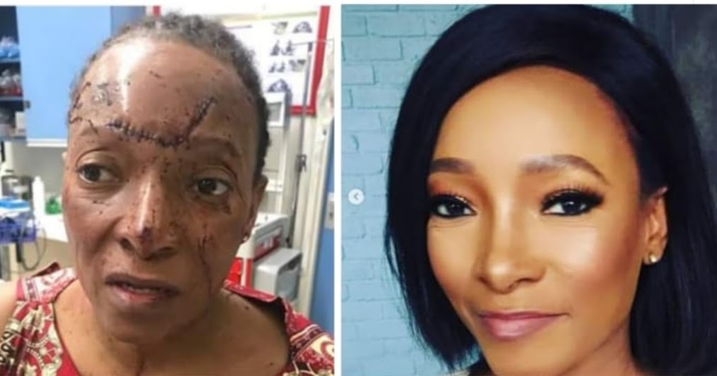 PICTURES: PALESA MADISAKWANE INVOLVED IN A HORRIFIC CAR ACCIDENT
