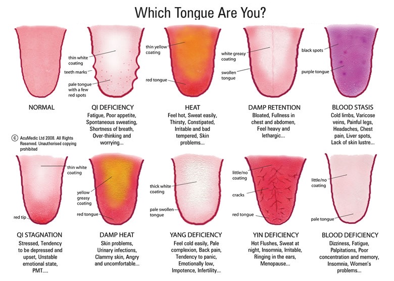 SujokTherapy Zone Tongue Diagnosis