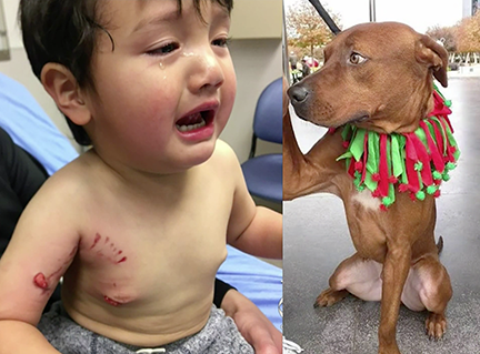 safety before pit bulldogs