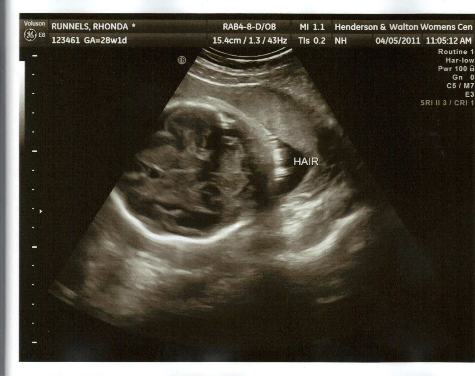 The Runnels Family 4D Ultrasound