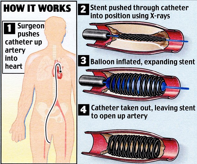 Duke of Edinburgh taken to hospital with chest pains and treated for a