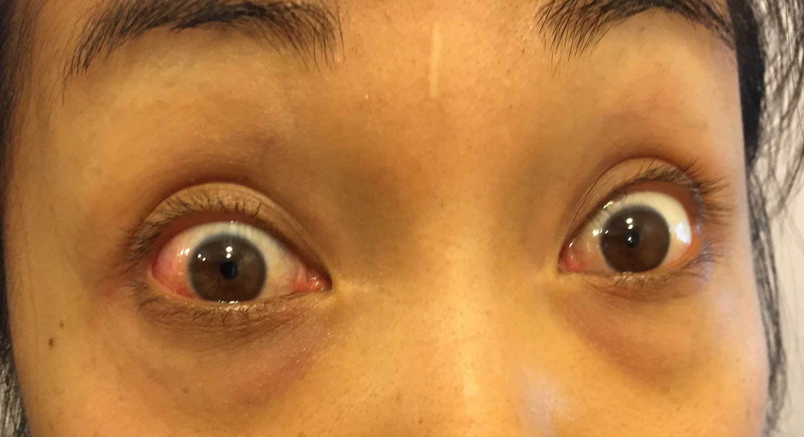 My eye Eyes the least red it will be (first waking up in the morning)
