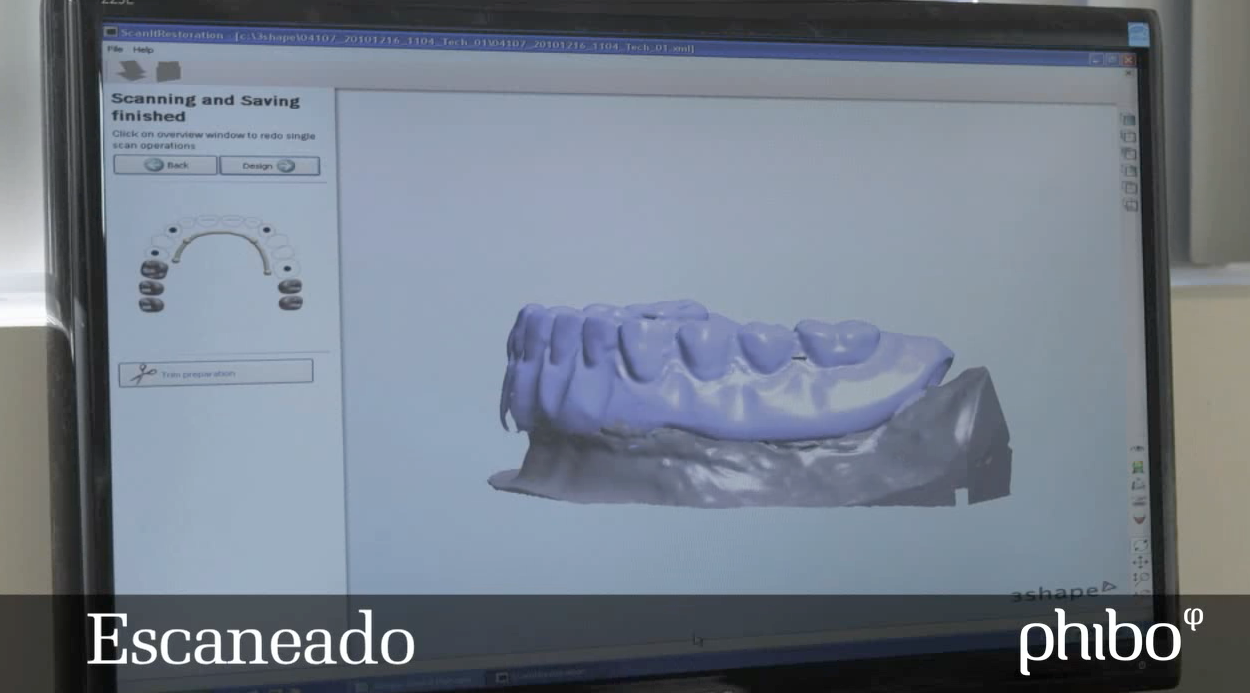 i2 Actualidad: LA TECNOLOGÍA CAD-CAM EN ODONTOLOGÍA