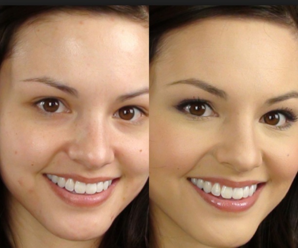 Best Makeup For Covering Acne Scars Feedtheking