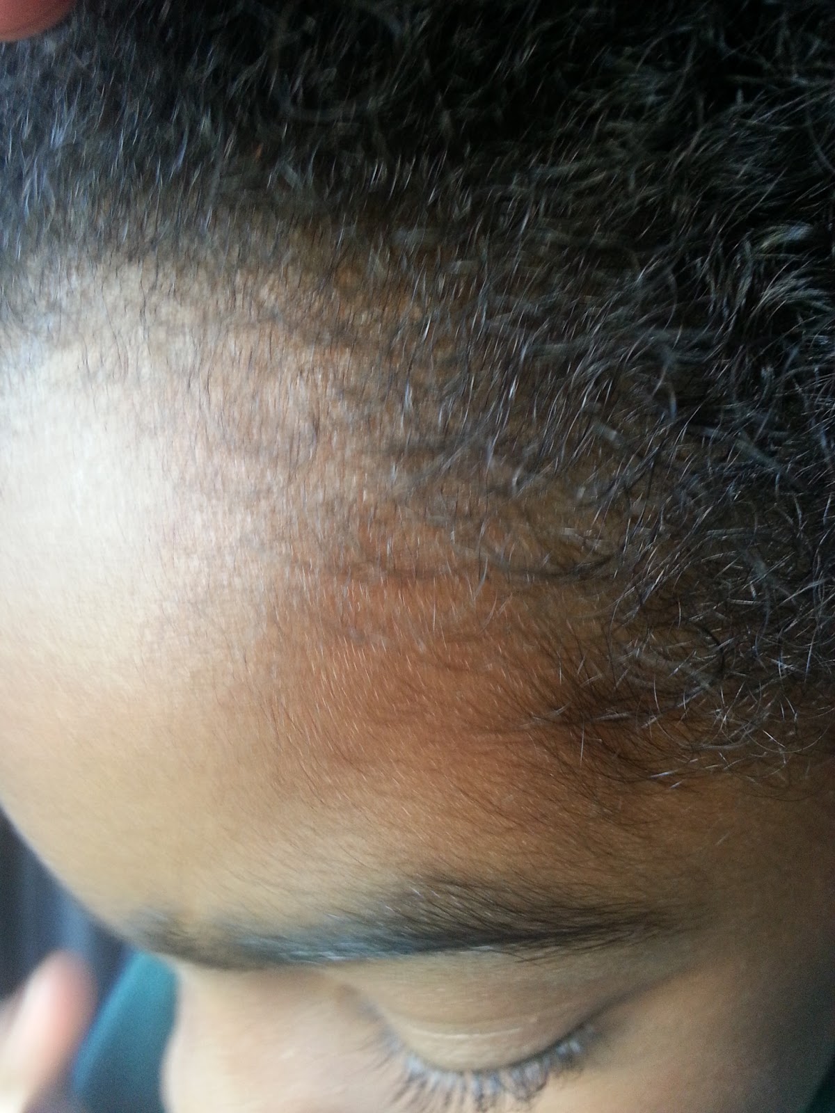 HOW TO CARE FOR COILY HAIR How To Avoid Hairline Breakage or Damage on