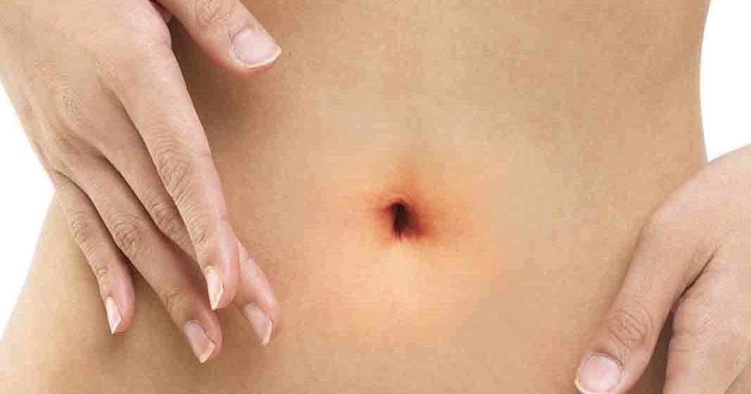 почему из пупка запахло