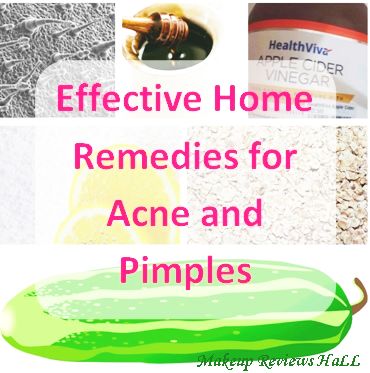 Effective Home Remedies for Acne & Pimples
