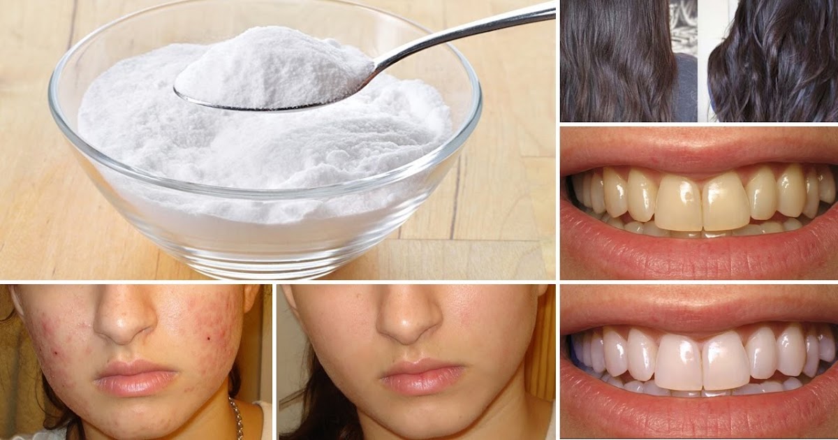 How to Use Baking Soda To Clean Face Skin, Clean Your Hair And Whiten