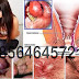 Wasir Menahun Sembuh Tanpa Operasi, Bagaimana Caranya thumbnail
