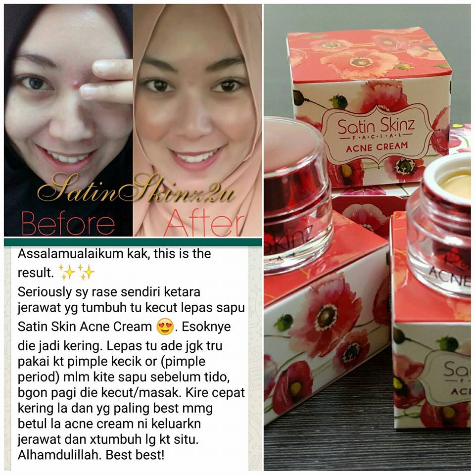 Satin Skinz Facial Acne Cream / Satin Skin Acne Serum / Satin Skinz Facial Green Tean Acne Murah