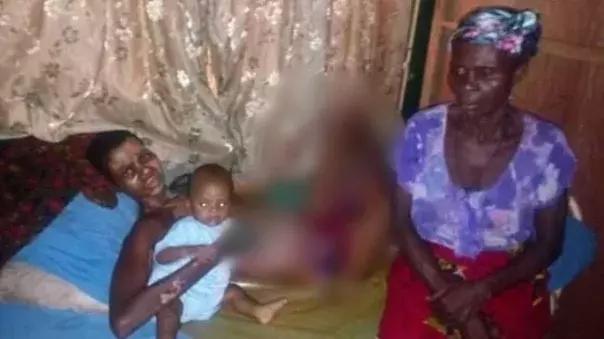 Kerosene explosion burns nursing mother of 7-month-old baby in Delta
