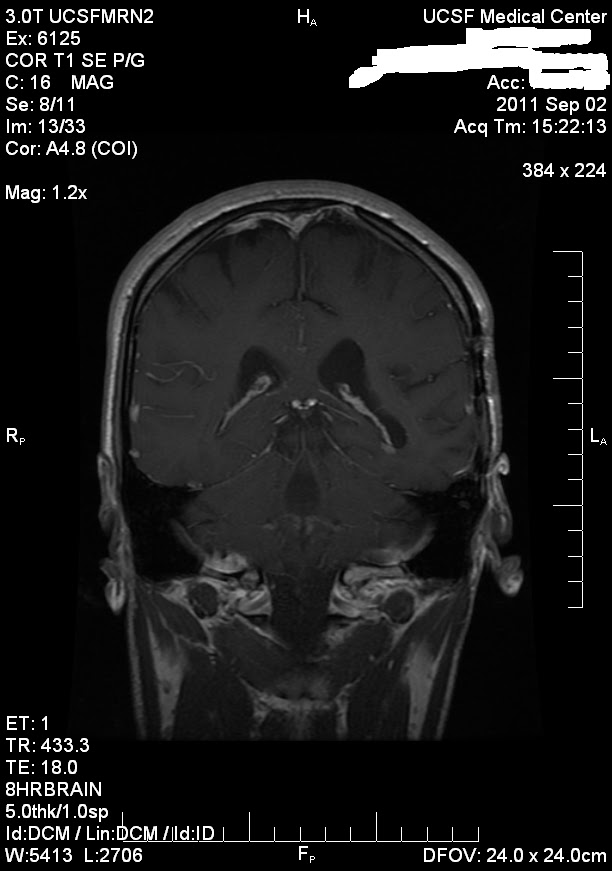 42 Staples November 2011