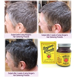 Dax Pomade Hair Loss Dax 2020