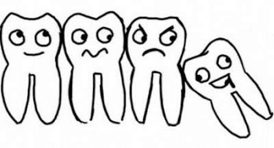 Răng khôn là răng số mấy?