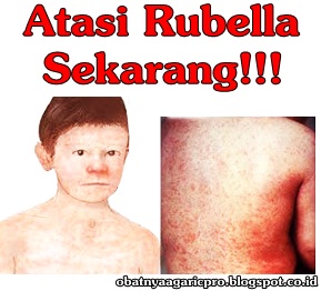 Obat Rubella Obat Rubella