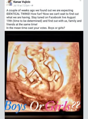 Photos: Limbless Pastor, Nick Vujicic And Wife Are Expecting Twins