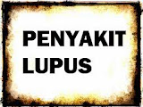 Penyakit Lupus