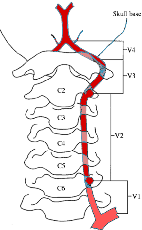 Vertebral Artery Anatomy Vertebral Artery Anatomy