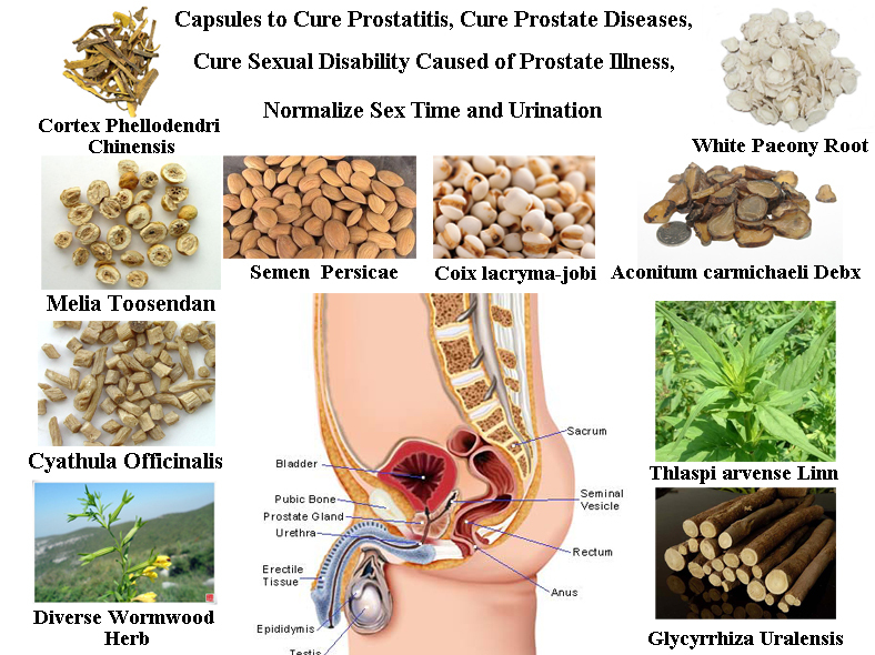 krónikus prostatitis t