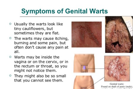 Can genital warts be non-sexually transmitted infections Can genital warts be non-sexually transmitted infections