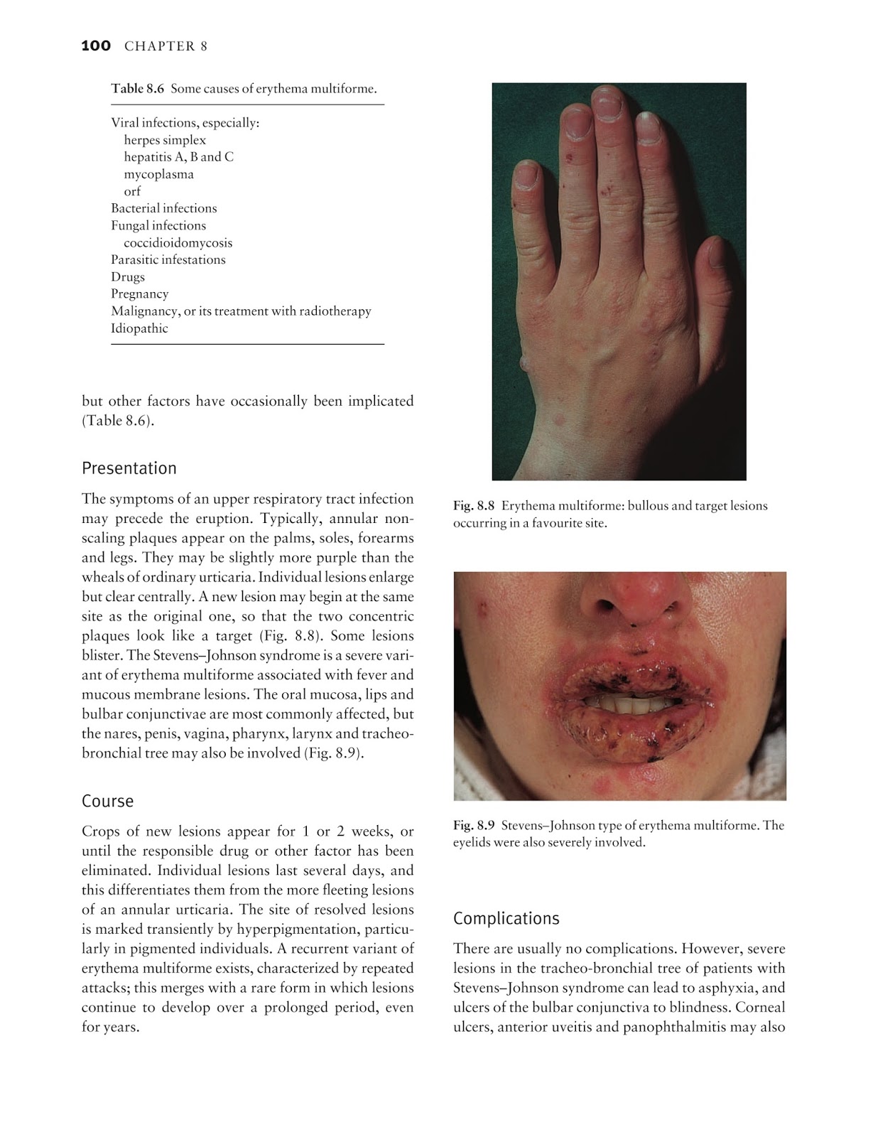 Medicine by Sfakianakis G. Alexandros: Skin disease in perspective 4