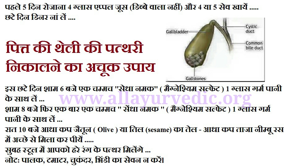सिर्फ 6 दिन में पित्त की थेली की पत्थरी निकालने का अचूक उपाय, इस