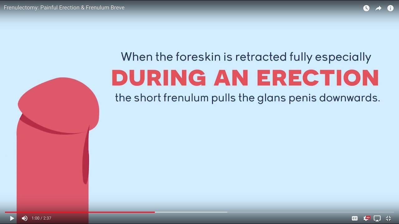 Penis frenulum