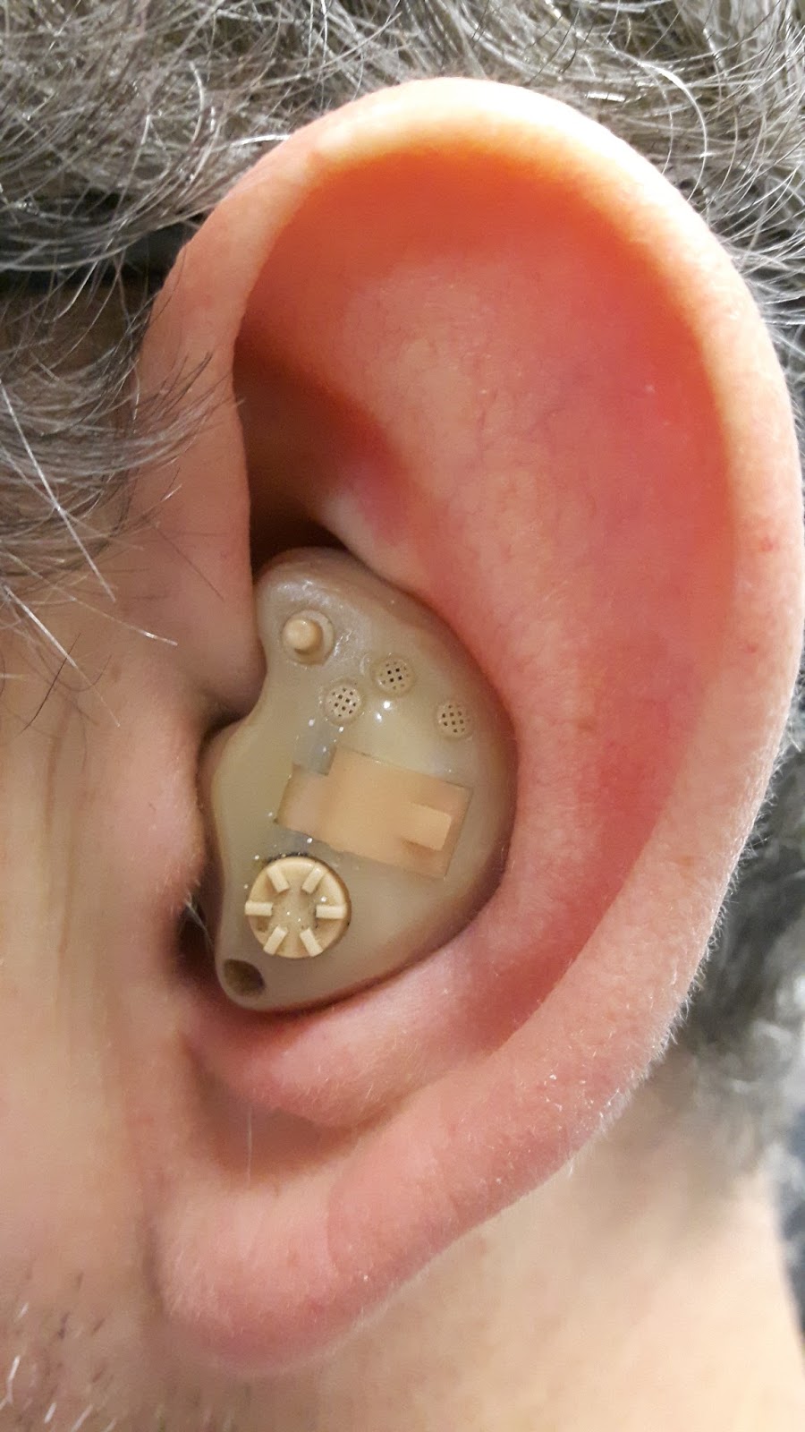 New patient in Leeds moves from ugly hearing aid to a
