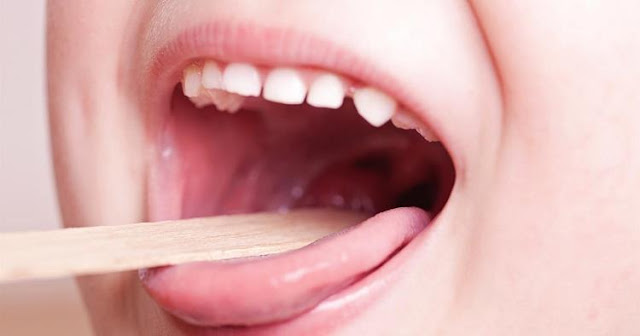Cara Mengobati Amandel Tanpa Oprasi, Cukup Minum 5 Ramuan Obat Alami Ini Cara Mengobati Amandel Tanpa Oprasi, Cukup Minum 5 Ramuan Obat Alami Ini