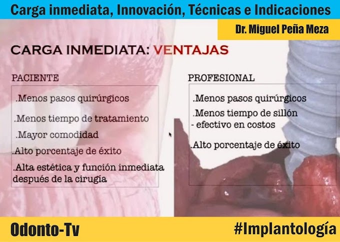 CARGA INMEDIATA: Innovación en Implantología, Técnicas e Indicaciones - Dr. Miguel Peña Meza