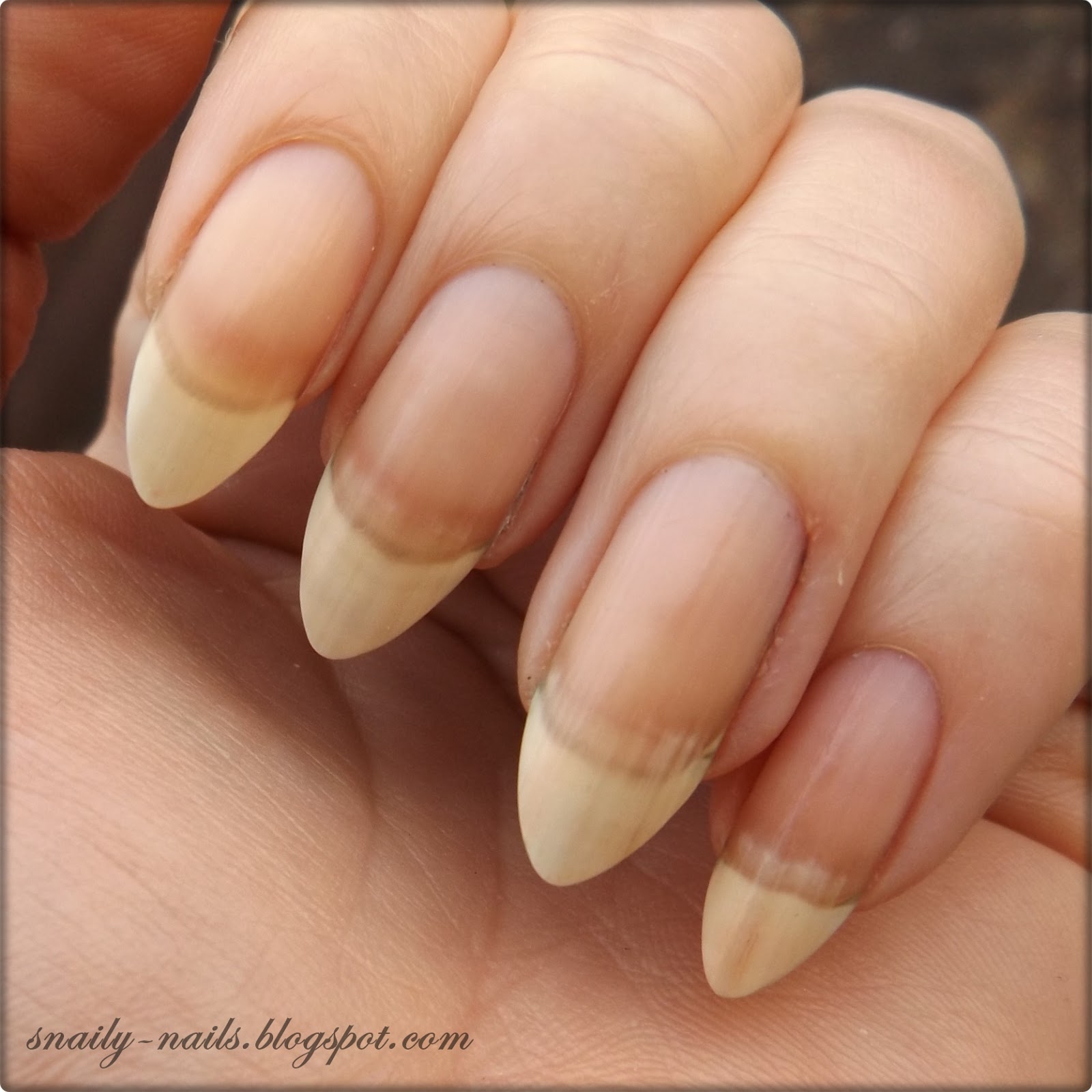 Onycholiza Moja Przygoda Czesc 1 Snaily