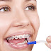  تقويم الأسنان نصائح هامة للعناية به