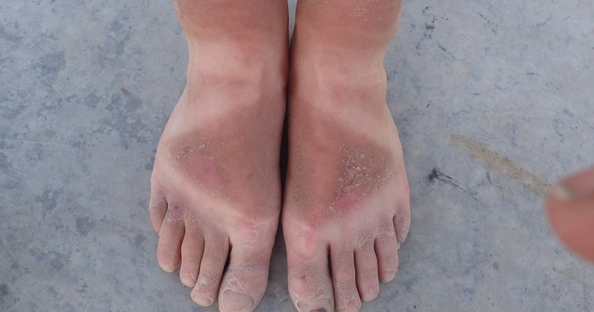 chacos on people's feet