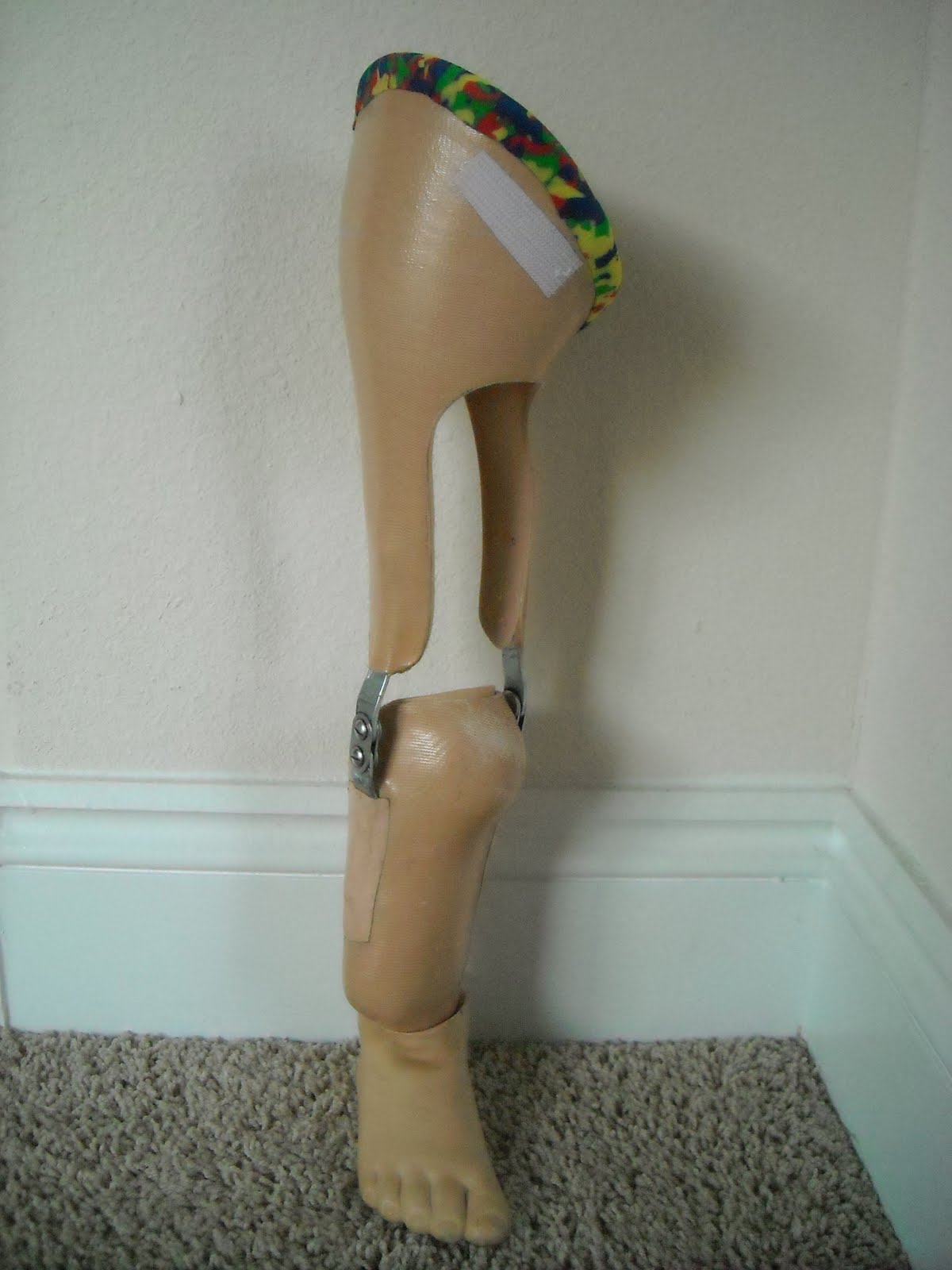Mason's Progress with PFFD: 3rd Edition Prosthesis