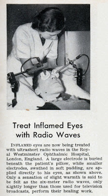 Treat Inflamed Eyes with Radio Waves