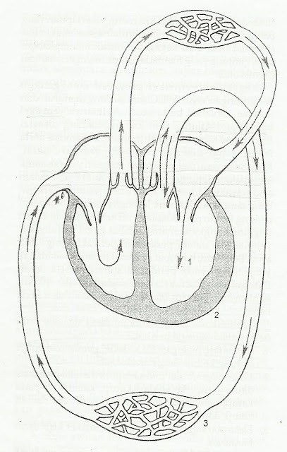 Patofisiologi Insufisiensi regurgitasi katup aorta