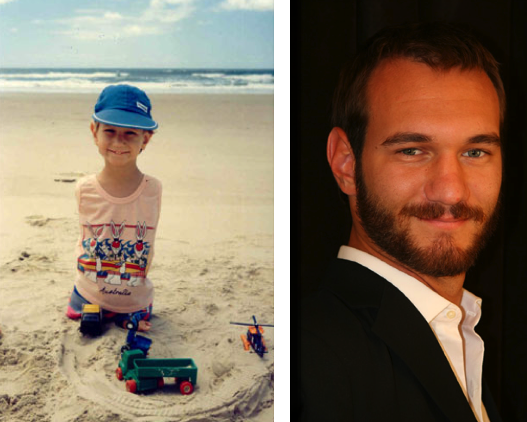 They won in life! Nick Vujicic