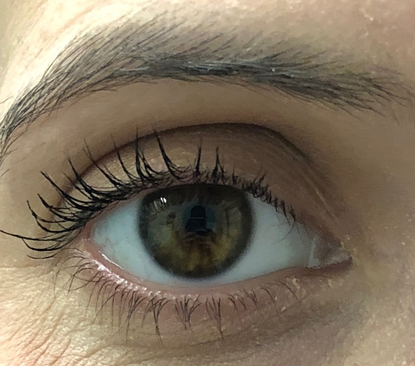 Let There Be White LUMIFY is the Red Eye Drop Your Eye Doctor Always