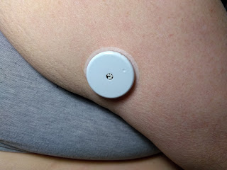sensor in my arm