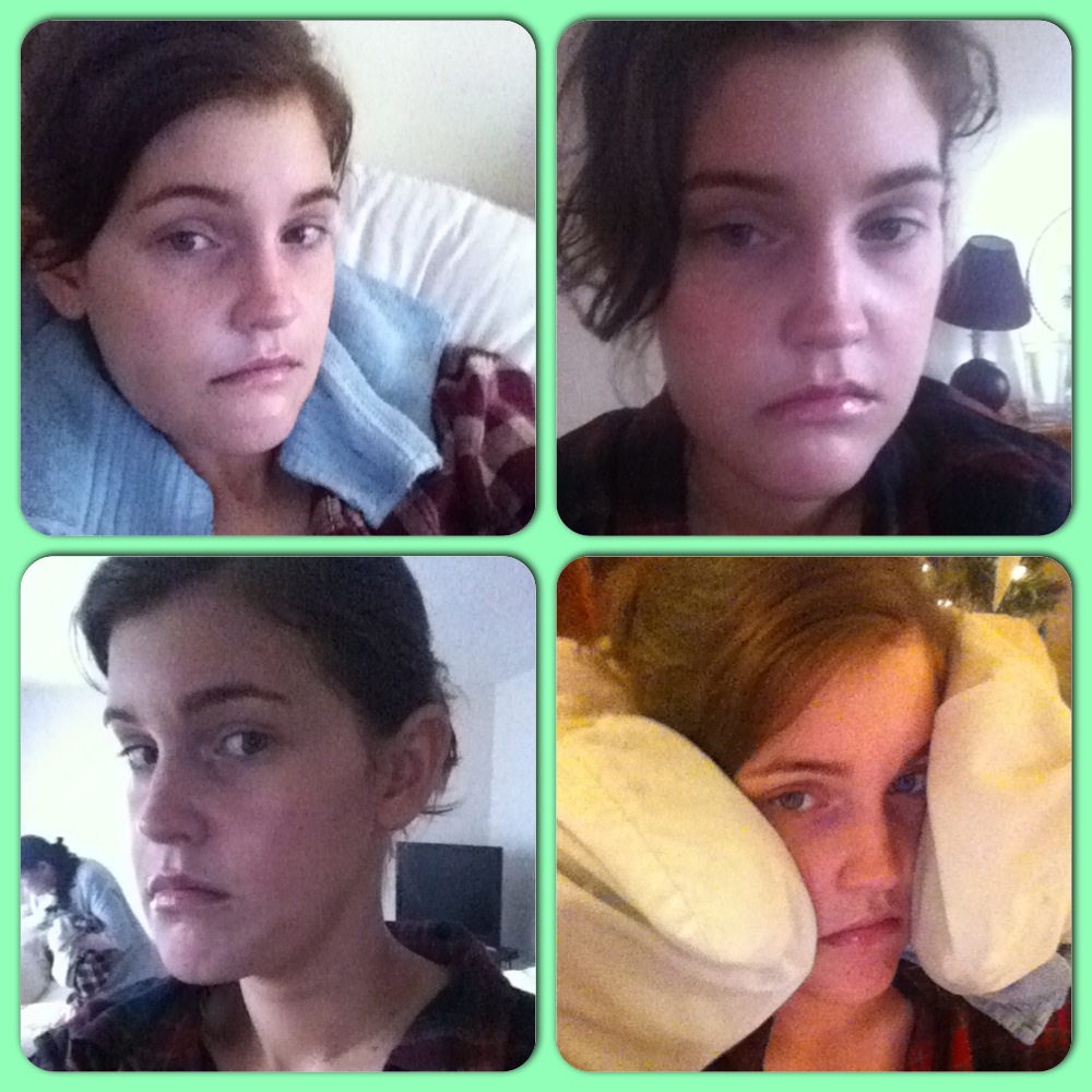 A Guide to Surviving Orthognathic Surgery Recovery from Plate & Screw