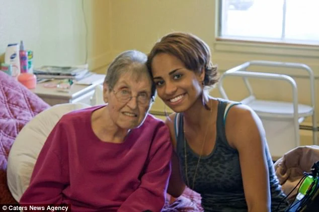 PERSONAS CON VITILIGO Jasmine Colgan con su abuela